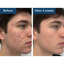 Lumiskin Copper Peptide Serum